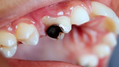 dental platform